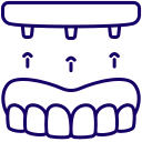 Implant Treatment