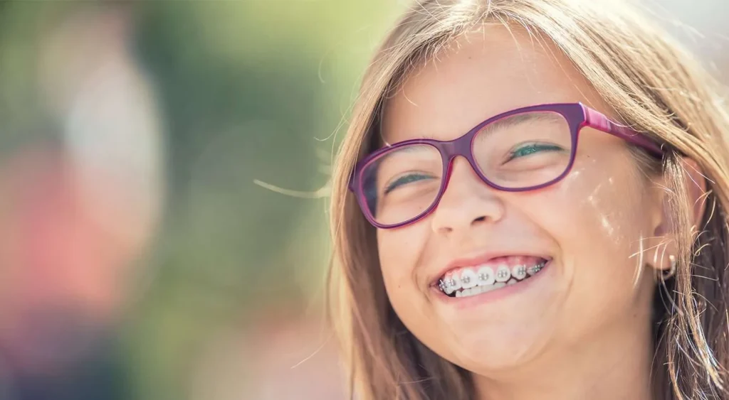 Dental Braces